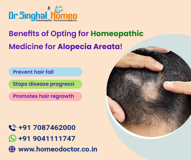 Benefits-of-Opting-for-Homeopathic-Medicine-for-Alopecia-Areata